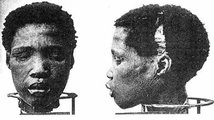 Egy orvosi vizsgálat céljából eltávolított emberi fej a Cápa-szigetről (kép forrása: Wikimedia Commons)