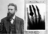 Wilhelm Conrad Röntgen, mellette felesége kezének röntgenképe